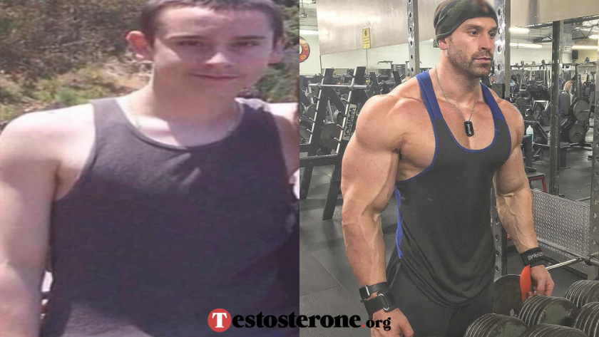 Bradley Martyn steroids before and after